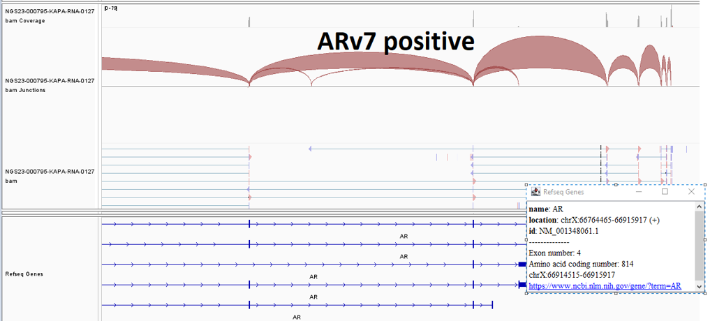 Figure 1: ARV7 positive