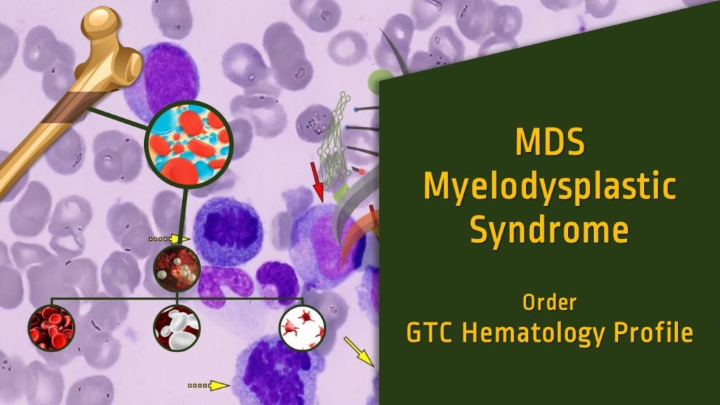Myelodysplastic Syndrome Mds Genomic Testing Cooperative