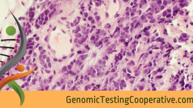 Genomic Testing Cooperative Receives Medicare Coverage for GTC-Solid Tumor Profile (434 gene) Test