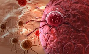 cancer-cell tumor-informed vs tumor-naive