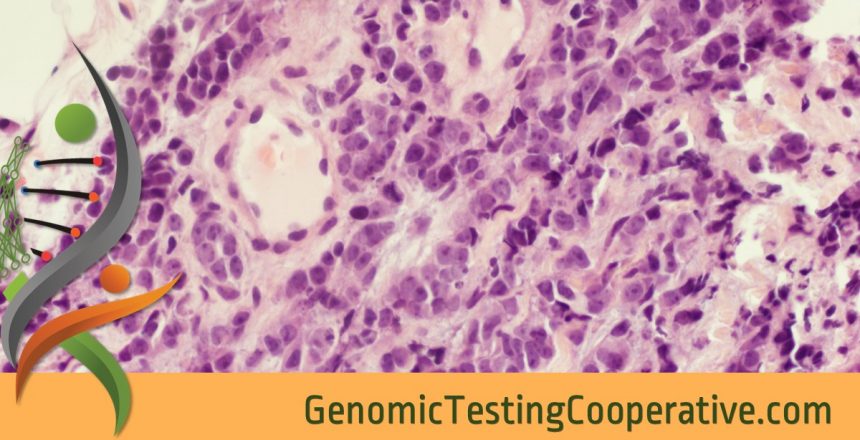 Genomic Testing Cooperative Receives Medicare Coverage for GTC-Solid Tumor Profile (434 gene) Test