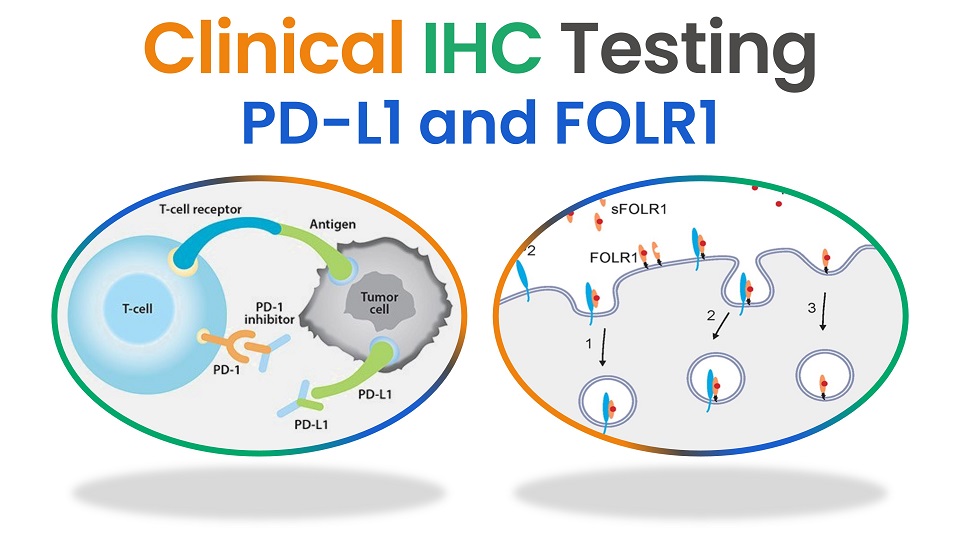 IHC clinical testing for PD-L1 and FOLR1